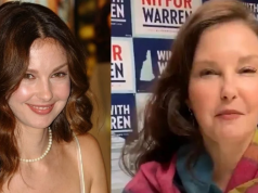 What Happened To Ashley Judd'S Face?