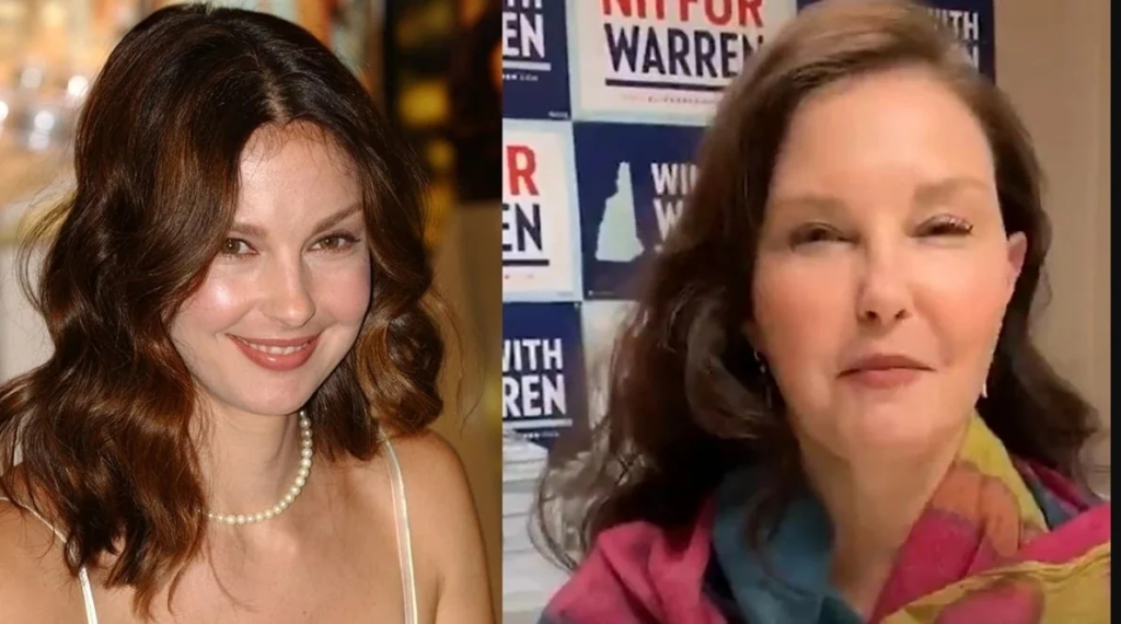 What Happened To Ashley Judd'S Face?