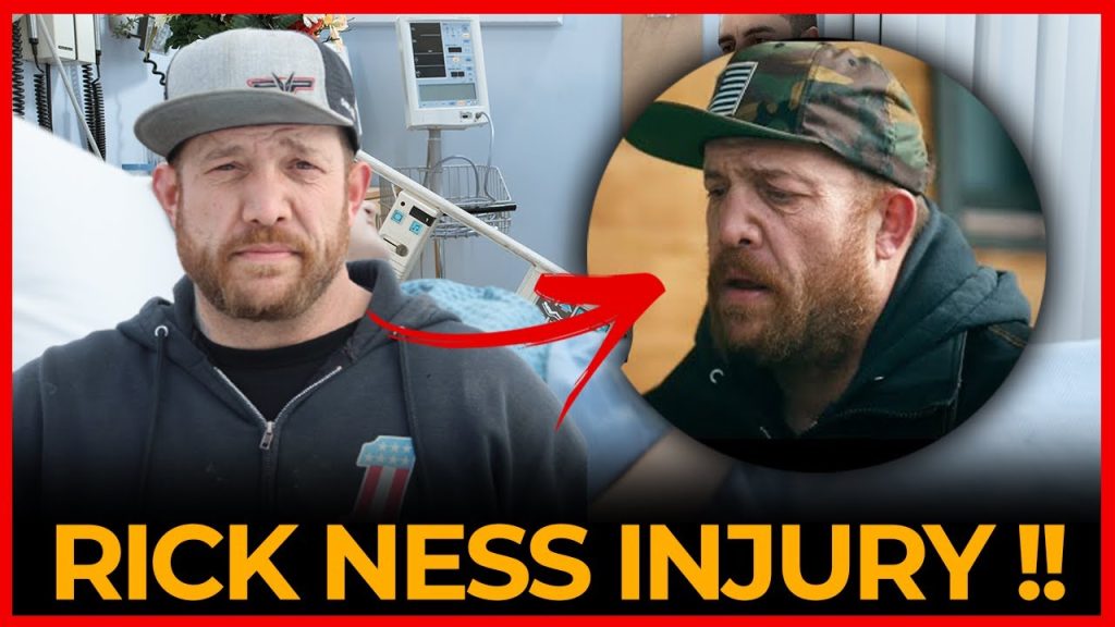 What Happened To Rick Ness Nose?