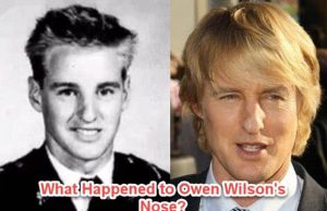 What Happened To Owen Wilson'S Nose?