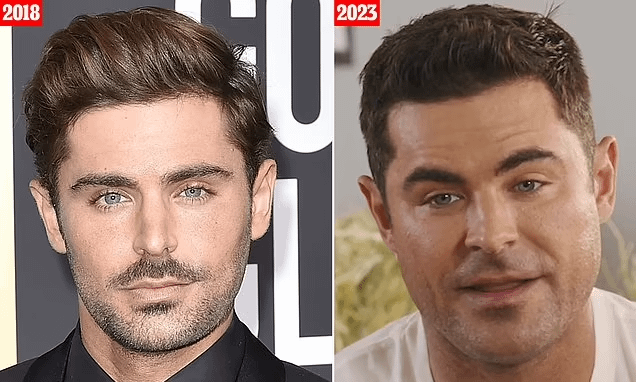 What Happened To Zac Efron'S Face?